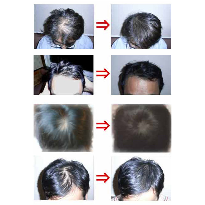 ハゲ・抜け毛・薄毛の悩みが7日で止まる!ヘアケア塾